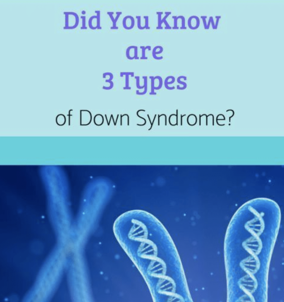 how is down syndrome diagnosed.